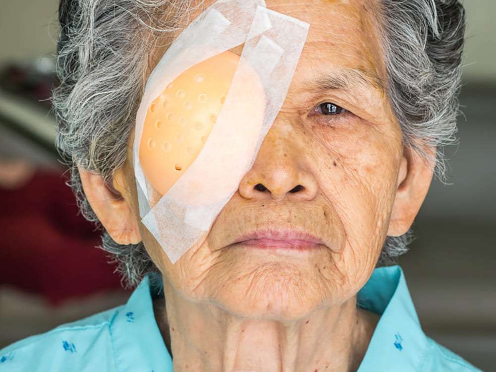 mổ cườm mắt cho người già