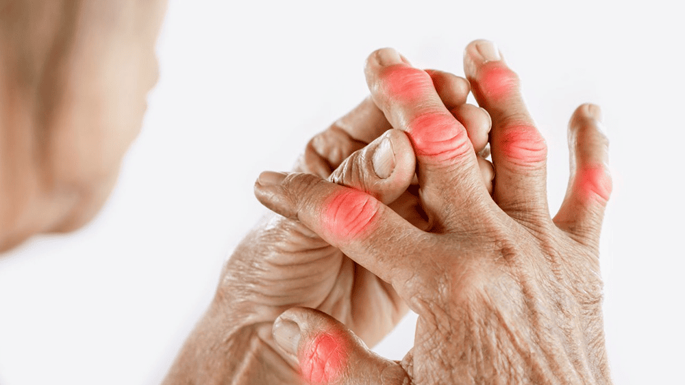 trieu-chung-viem-khop-dang-thap