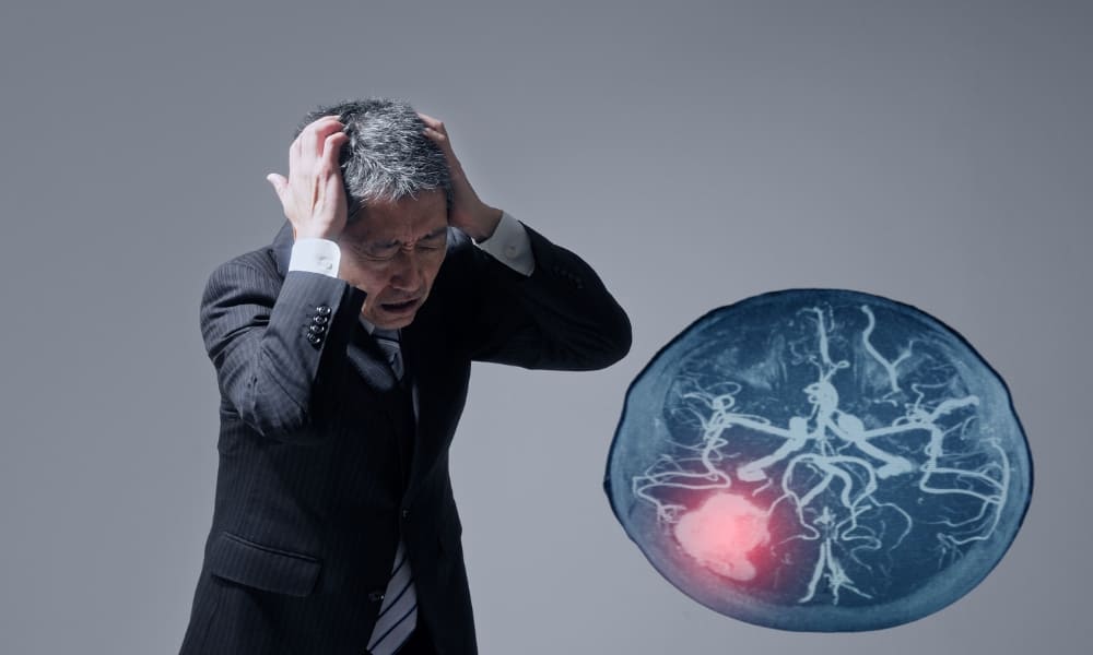 xuất huyết não ở người già