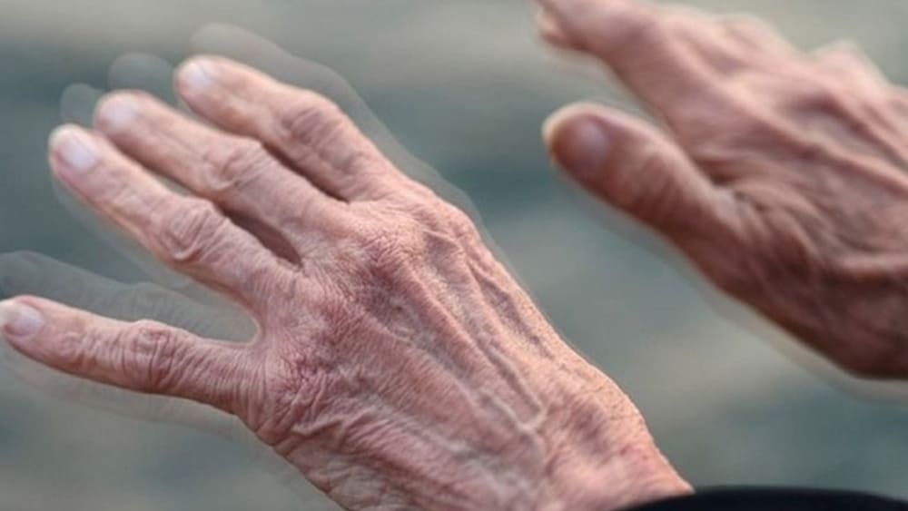 bệnh run tay ở người già