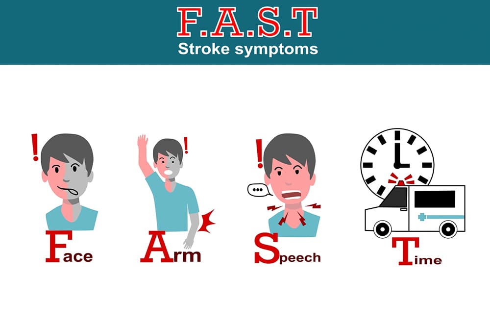 sơ cứu đột quỵ tại nhà