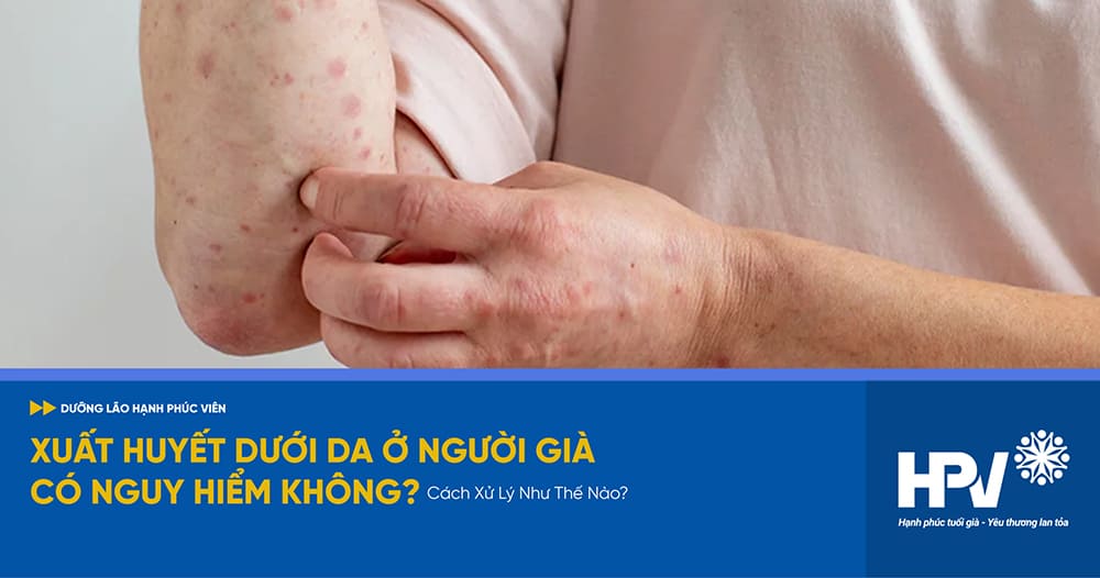 xuất huyết dưới da ở người già